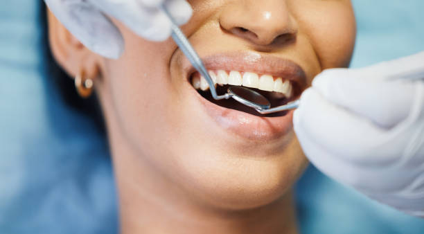 Best Emergency Tooth Extraction in Windber, PA