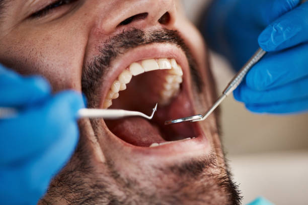 Best Emergency Dental Care for Trauma or Injury in Windber, PA