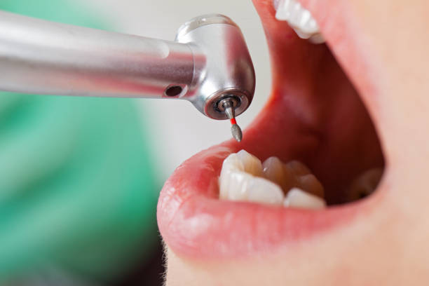 Best Emergency Dental Surgery in Windber, PA